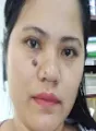 Melgen Seno